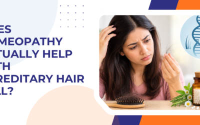 Does Homeopathy Actually Help With Hereditary Hair Fall?